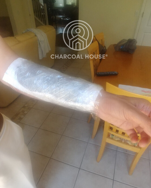 4282020 530pm 1 - MD Uses Activated Charcoal For A Nasty Rash
