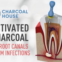 charcoal 250x250 - Activated Charcoal for Root Canal, Jaw Infection