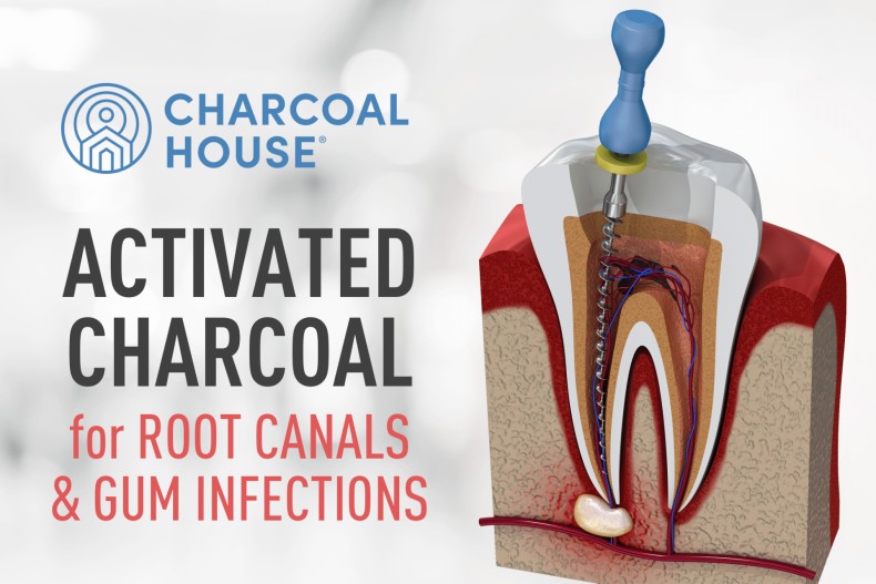 charcoal - Activated Charcoal for Root Canal, Jaw Infection