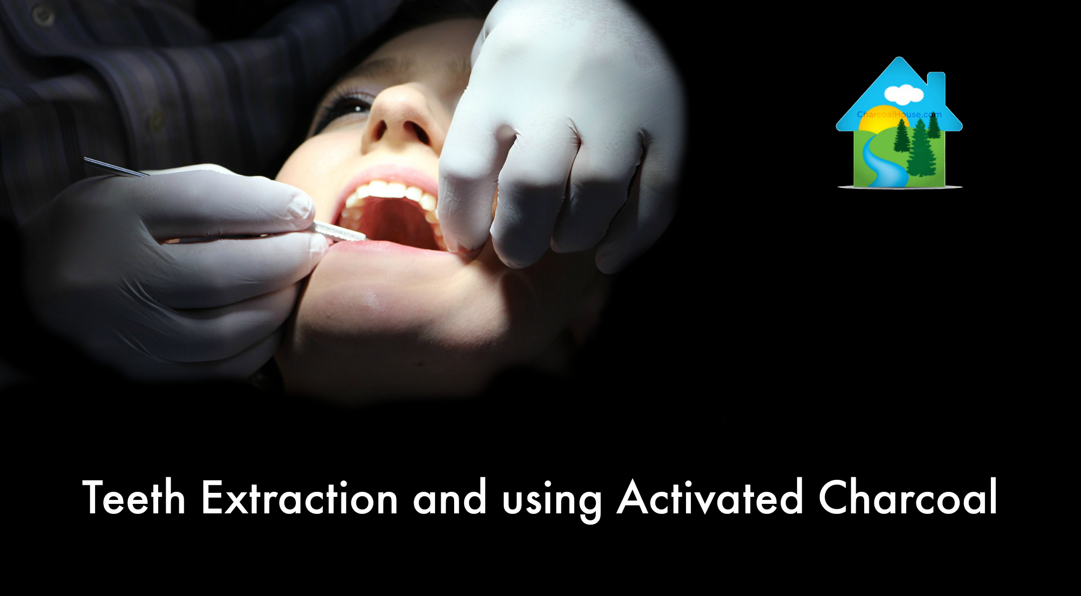Blog post Teeth Extraction Using Activated Charcoal - Teeth Extraction and Using Activated Charcoal