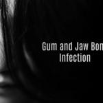 gum and jaw bone infection header 150x150 - Charcoal for Gum and Jaw Bone Infection
