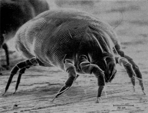 Dust mite - Activated Charcoal Kills Dust Mites